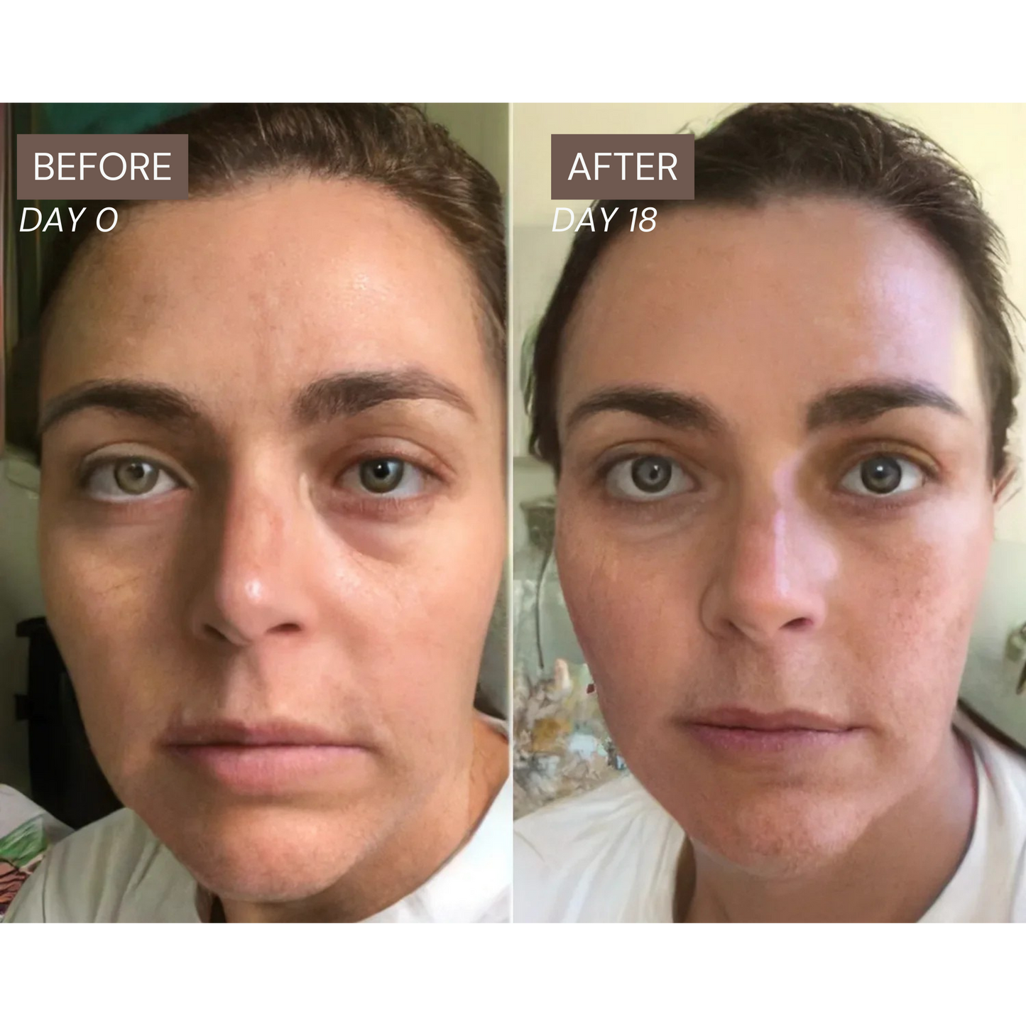 Radiance Lymphatic Brush