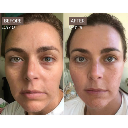 Radiance Lymphatic Brush