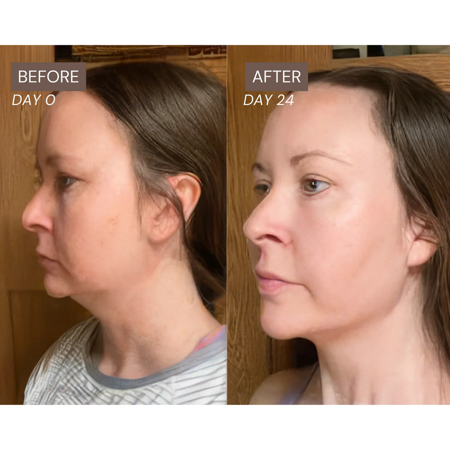 Radiance Lymphatic Brush