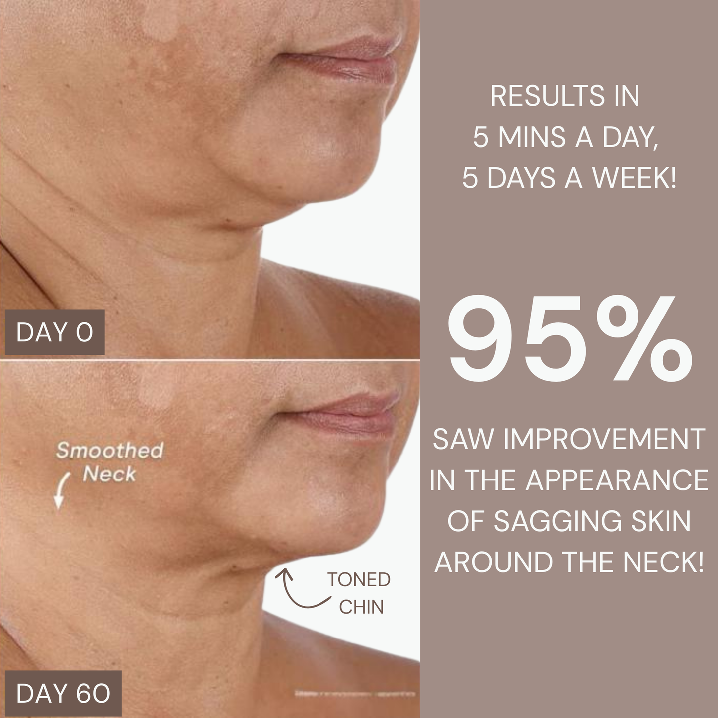 Radiance Lymphatic Brush