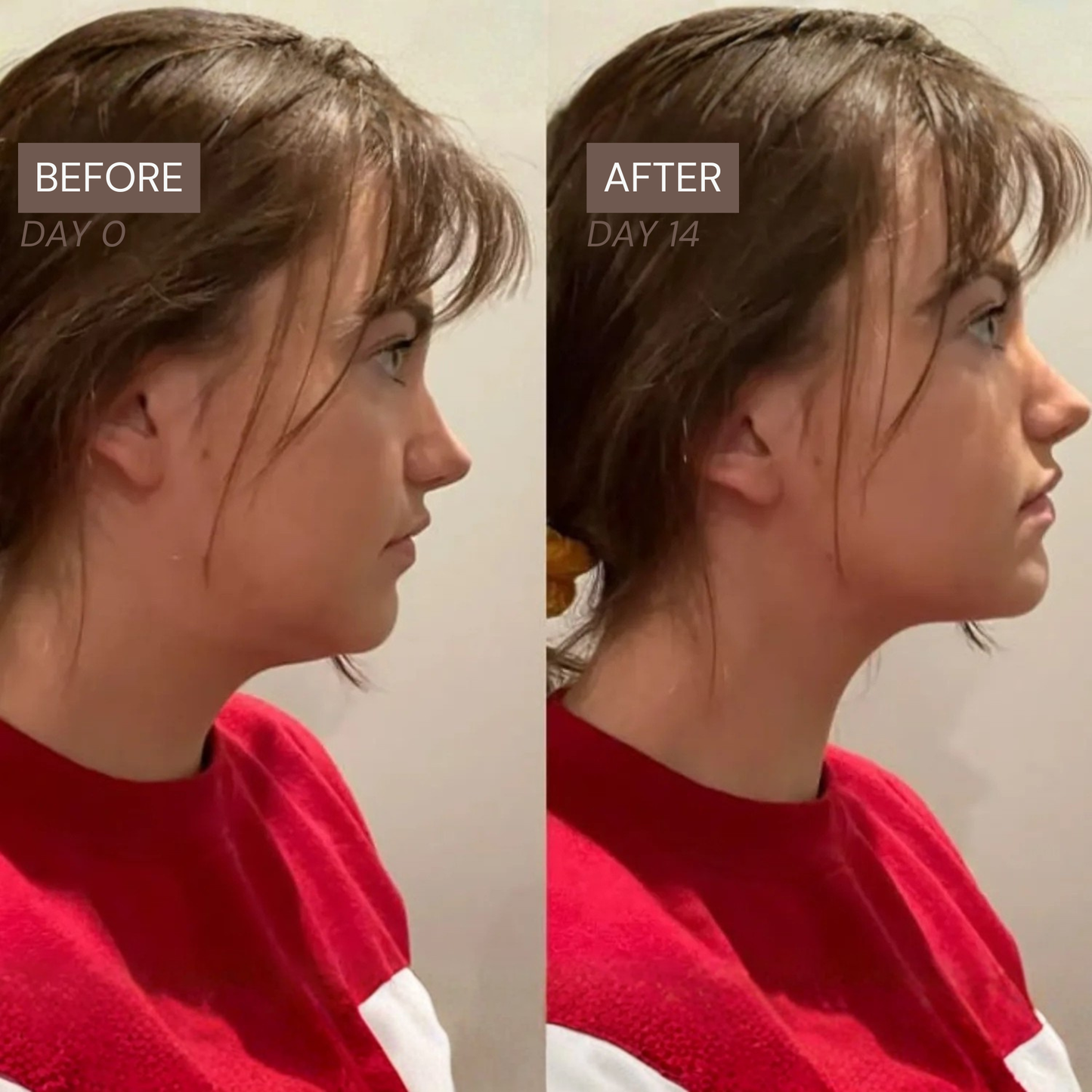 Radiance Lymphatic Brush