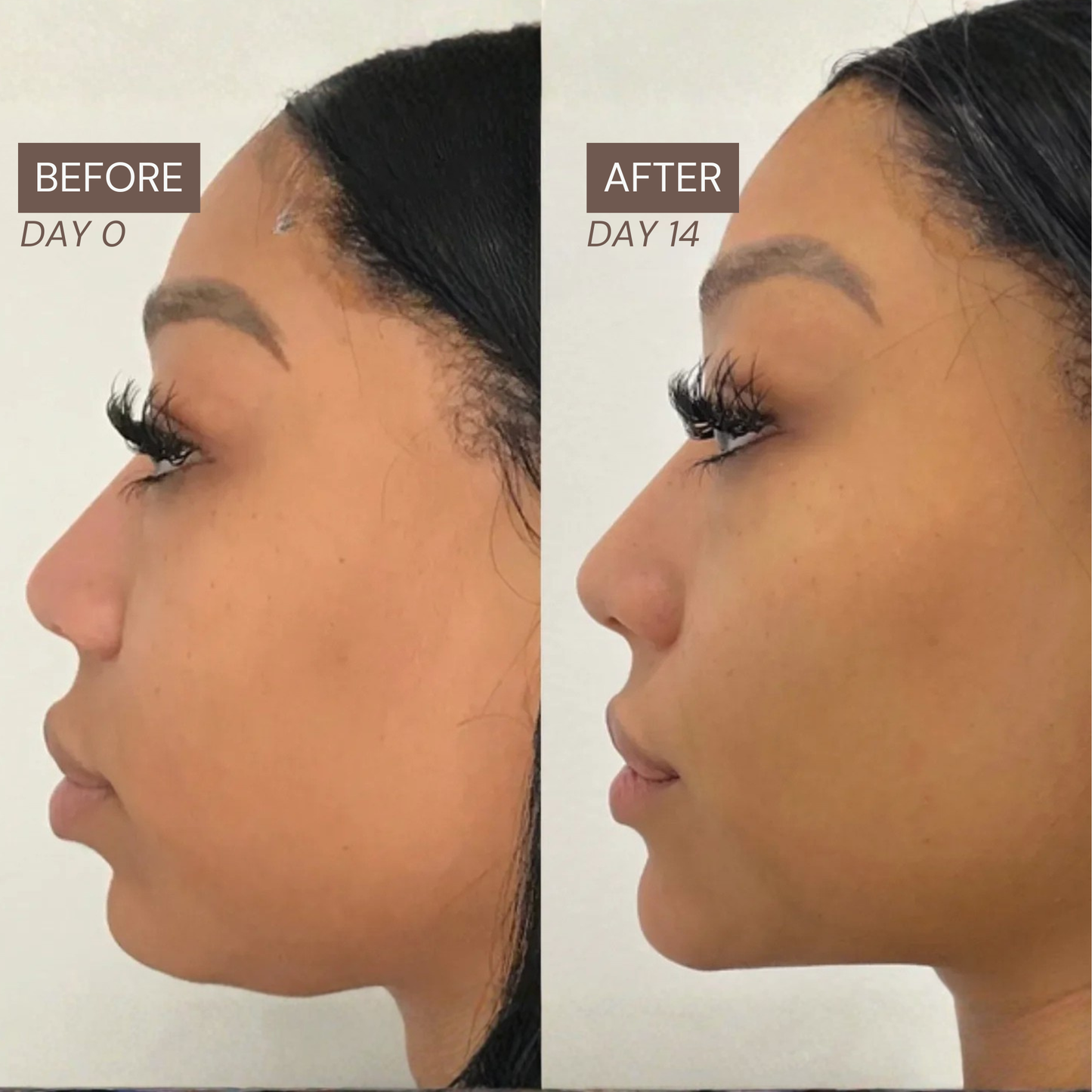 Radiance Lymphatic Brush